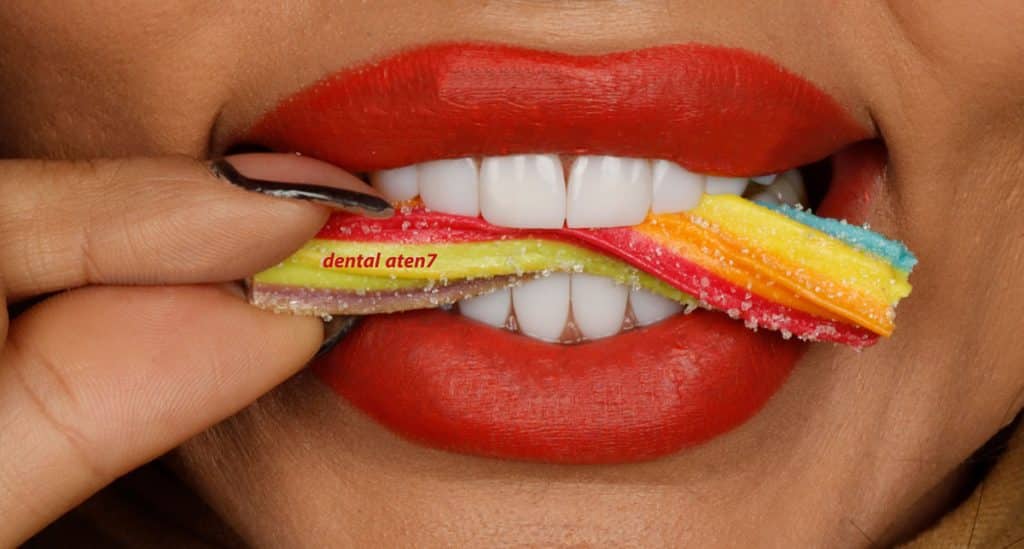 ونیر کامپوزیت برای