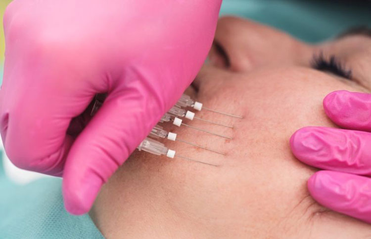 مزایای لیفت صورت بدون جراحی