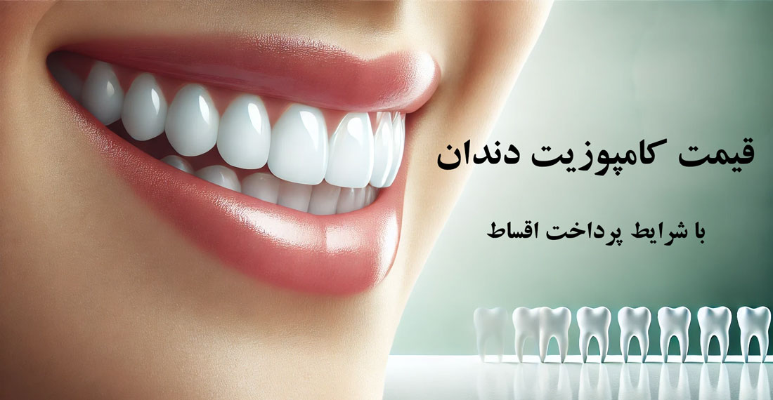 قیمت کامپوزیت دندان
